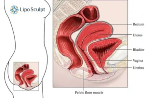 Treatment For A Leaky Bladder 2 How EM Chair treatment Central Milton Keynes can help Leaky bladder issues. Read more now!
