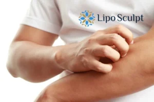 Best Actinic Keratoses Removal 4 prevent your actinic keratoses Central Milton Keynes getting worse - call our team today!