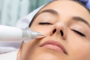 Best Actinic Keratoses Removal 3 Actinic keratoses Central Milton Keynes solutions - book in today!
